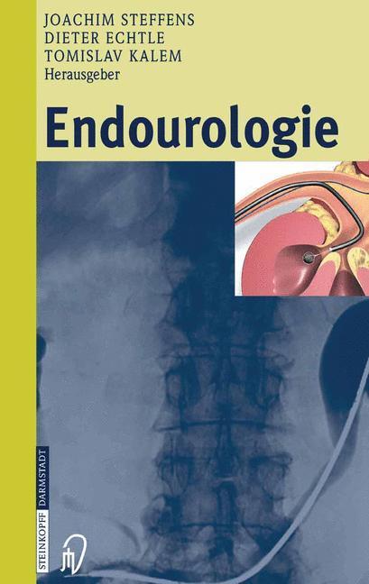 Cover: 9783642632570 | Endourologie | Joachim Steffens (u. a.) | Taschenbuch | Steinkopff
