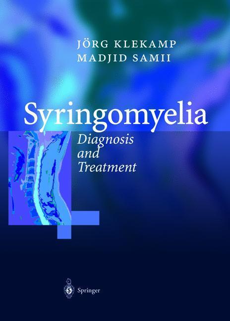 Cover: 9783642626517 | Syringomyelia | Diagnosis and Treatment | Jörg Klekamp (u. a.) | Buch