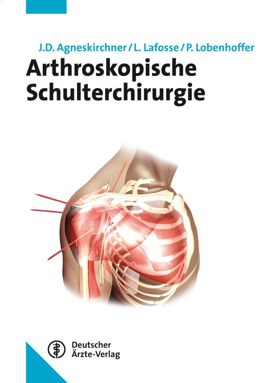 Arthroskopische Schulterchirurgie - Agneskirchner, Jens D.