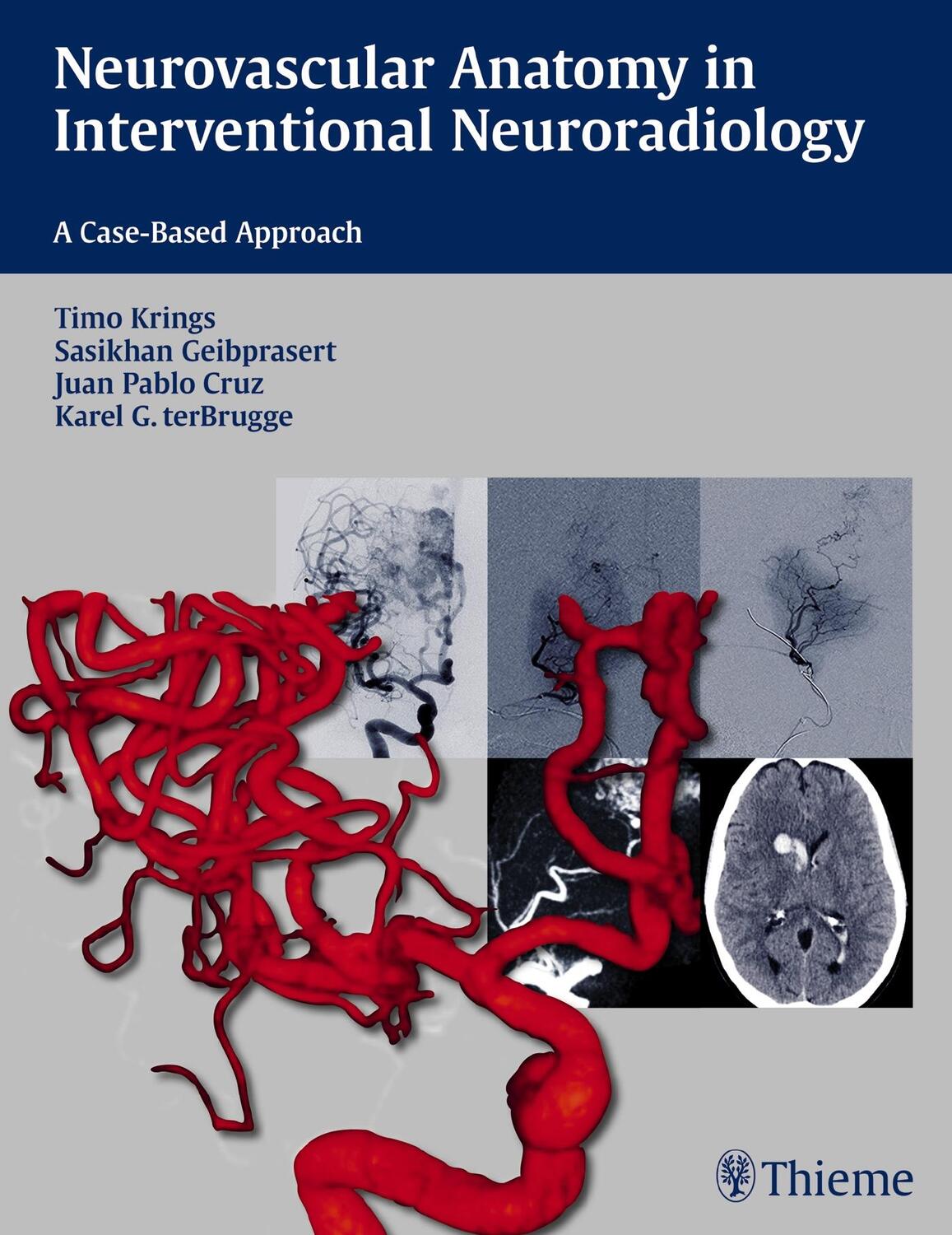 Cover: 9781604068399 | Neurovascular Anatomy in Interventional Neuroradiology: A...
