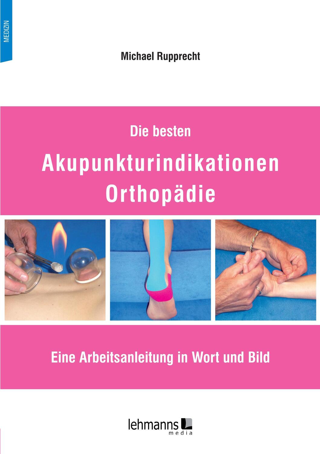 Cover: 9783965434127 | Die besten Akupunkturindikationen Orthopädie | Michael Rupprecht