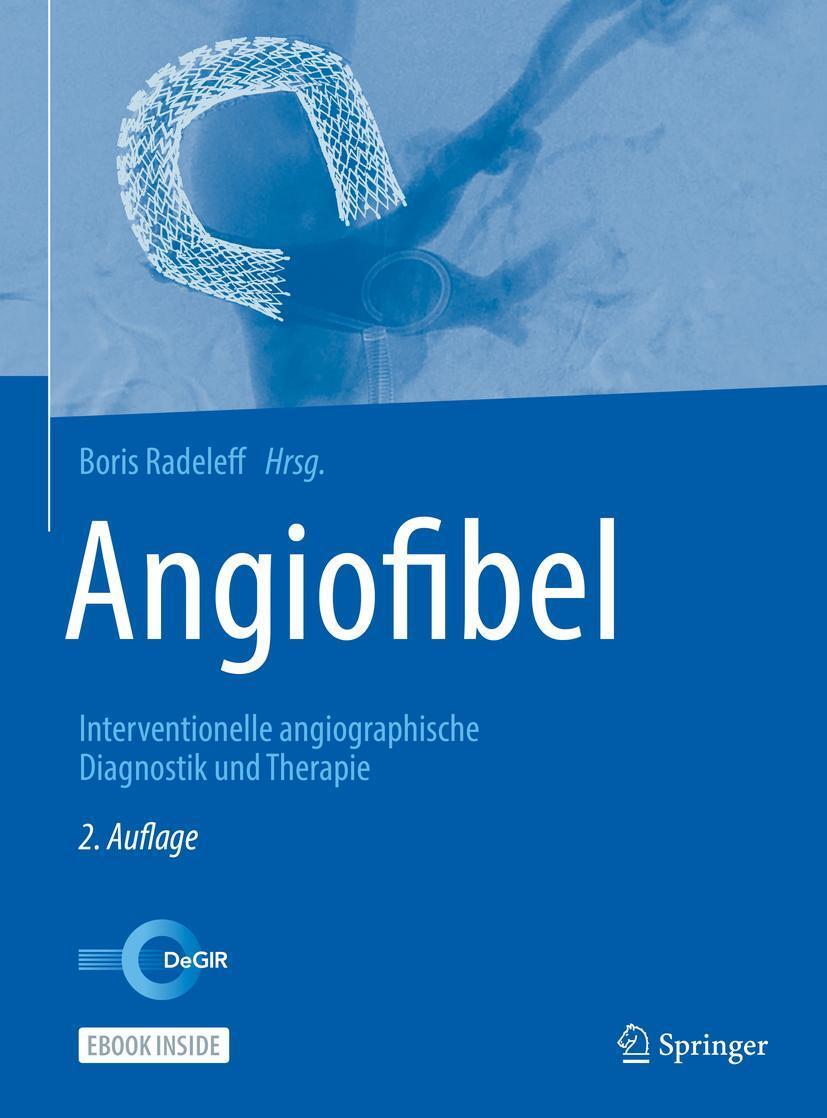 Cover: 9783662562420 | Angiofibel | Interventionelle angiographische Diagnostik und Therapie