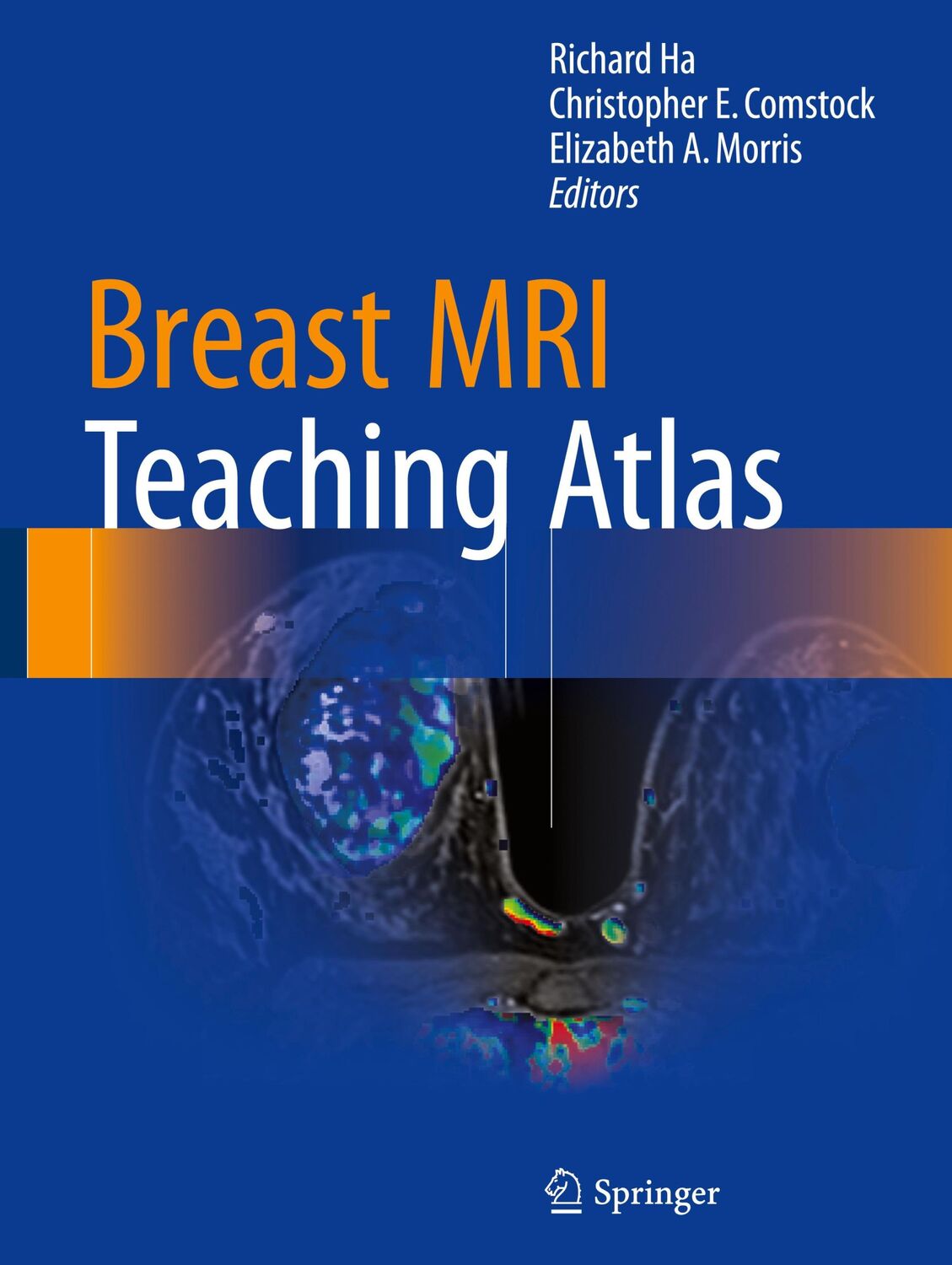 Cover: 9781493964079 | Breast MRI Teaching Atlas | Richard Ha (u. a.) | Buch | xi | Englisch