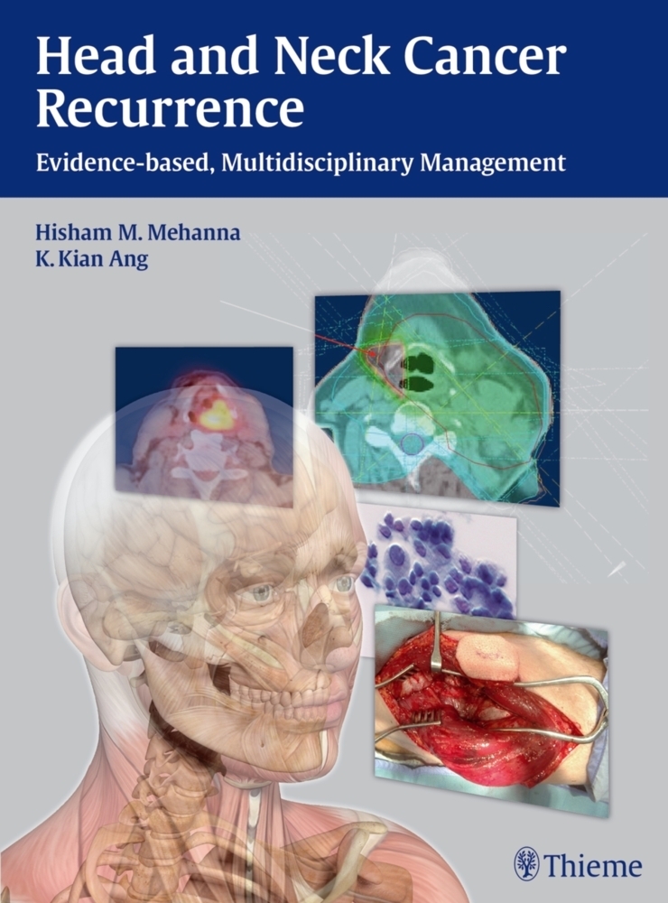 Cover: 9783131473912 | Head and Neck Cancer Recurrence | Hisham M. Mehanna (u. a.) | Buch