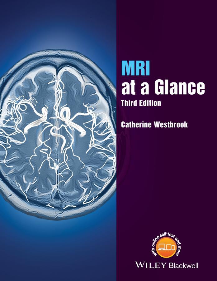 Cover: 9781119053552 | MRI at a Glance | Catherine Westbrook | Taschenbuch | At a Glance