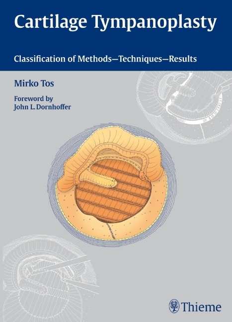 Cover: 9783131450913 | Cartilage Tympanoplasty | Mirko Tos | Taschenbuch | Englisch | 2009