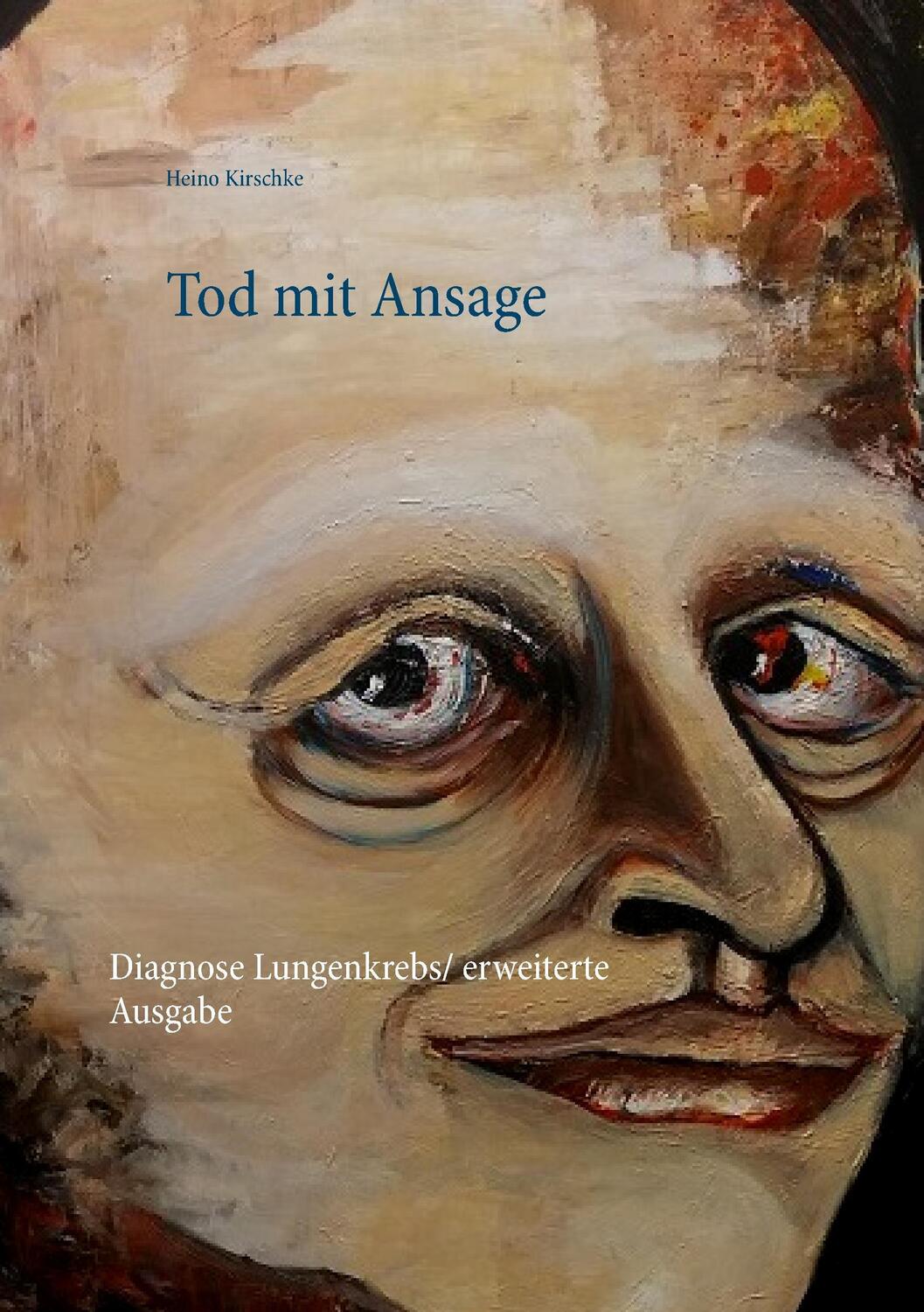 Cover: 9783743143487 | Tod mit Ansage | Diagnose Lungenkrebs / erweiterte Ausgabe | Kirschke