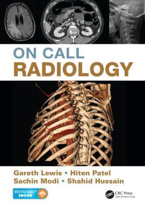 Cover: 9781482221671 | On Call Radiology | Gareth Lewis (u. a.) | Taschenbuch | Englisch