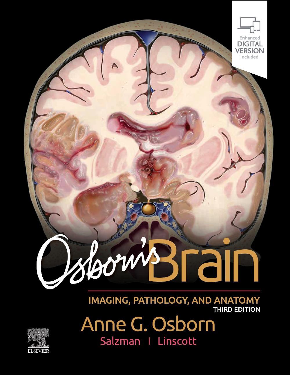 Cover: 9780443109379 | Osborn's Brain | Anne G. Osborn | Buch | Englisch | 2023