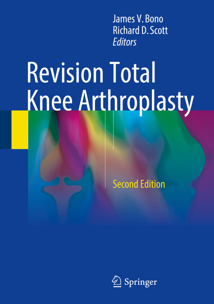 Cover: 9783319673424 | Revision Total Knee Arthroplasty | James V. Bono (u. a.) | Buch