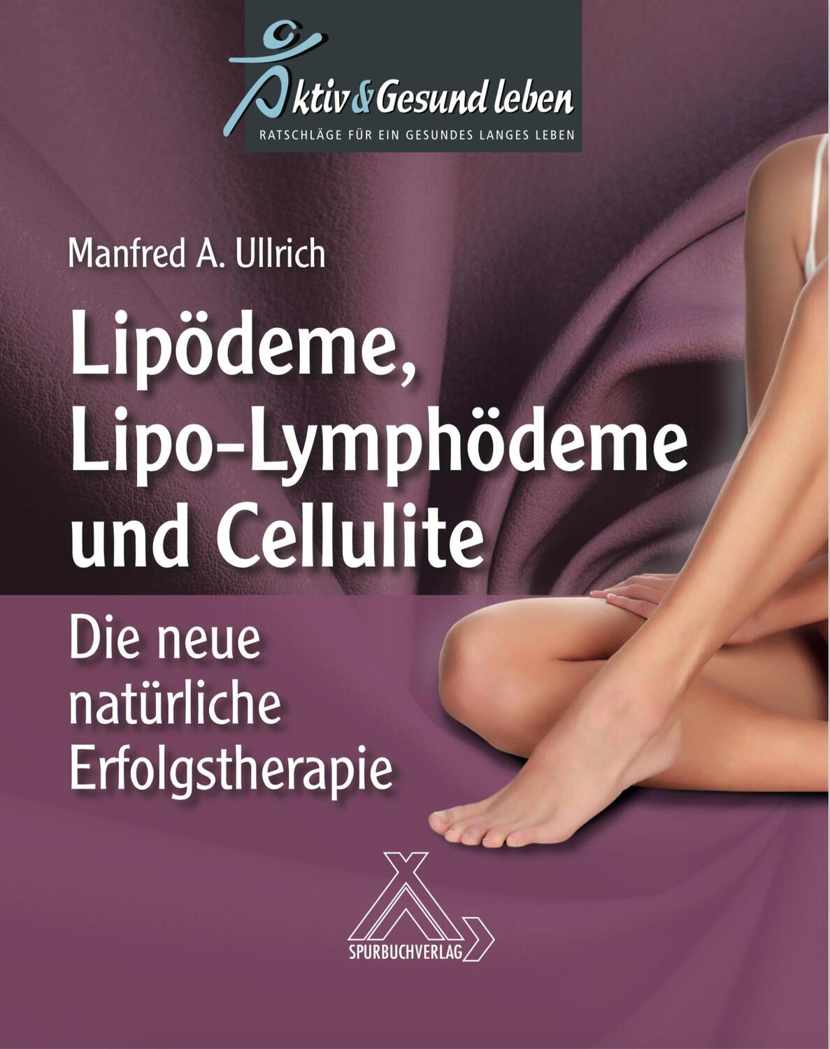 Cover: 9783887785833 | Lipoödeme, Lipo-Lymphödeme und Cellulite | Manfred A. Ullrich | Buch