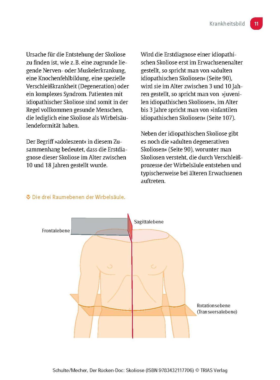 Bild: 9783432117706 | Der Rücken-Doc: Skoliose | Tobias L. Schulte (u. a.) | Taschenbuch