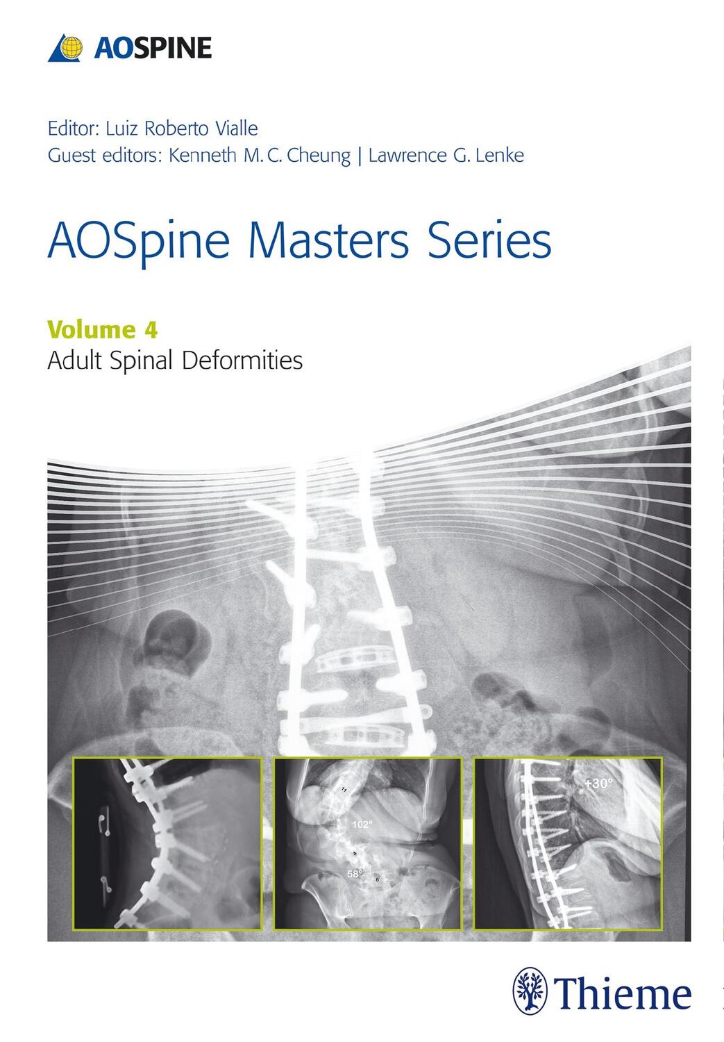 Cover: 9781626231009 | Aospine Master Series, Vol. 4: Adult Spinal Deformities | Buch | 2015
