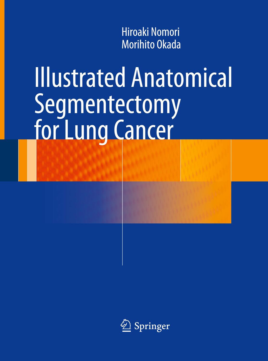 Cover: 9784431561217 | Illustrated Anatomical Segmentectomy for Lung Cancer | Okada (u. a.)