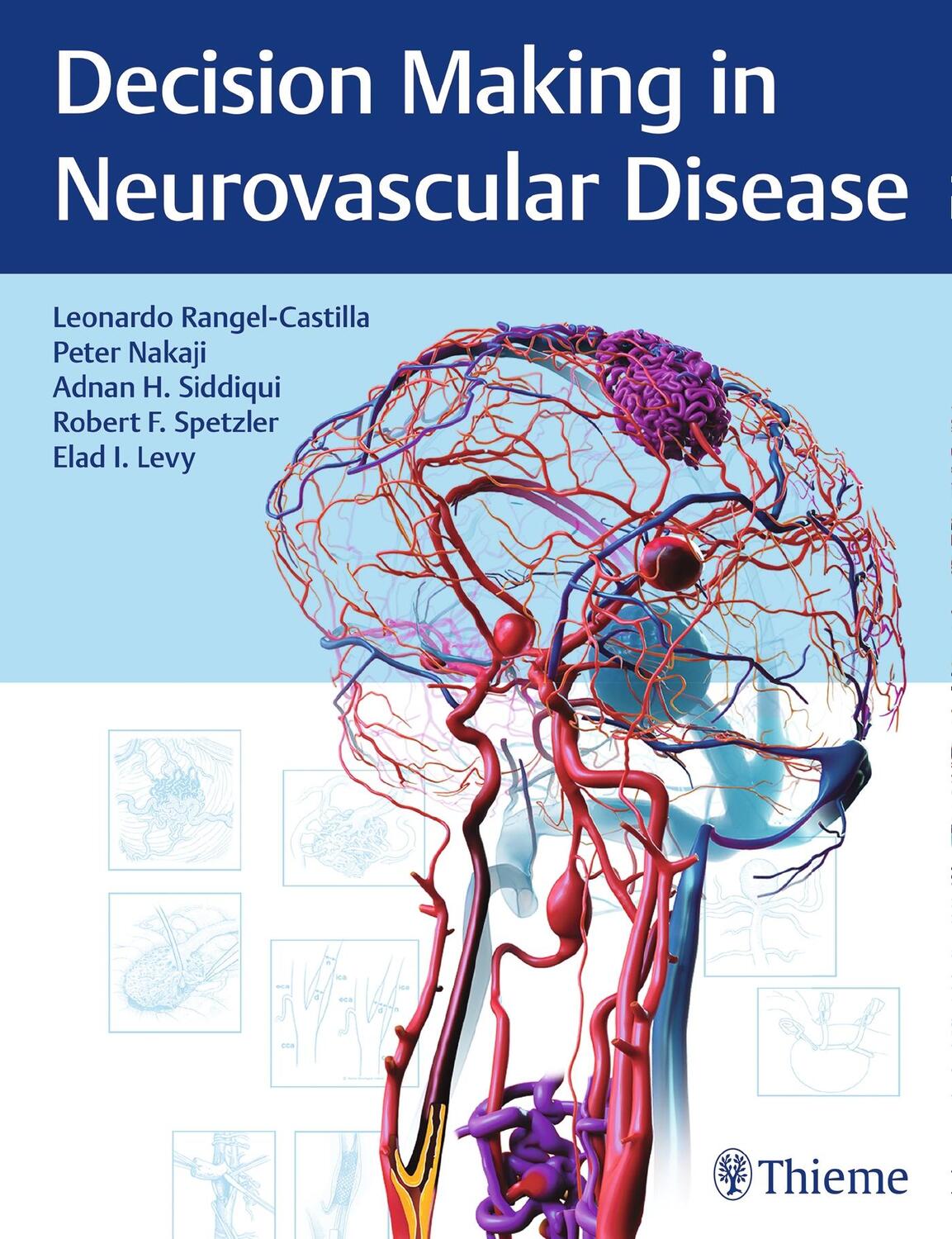 Cover: 9781684200573 | Decision Making in Neurovascular Disease | Rangel-Castilla (u. a.)