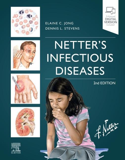 Cover: 9780323711593 | Netter's Infectious Diseases | Buch | Englisch | 2021