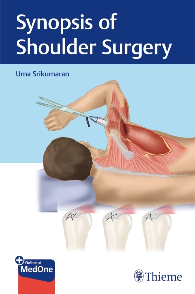 Cover: 9781684200801 | Synopsis of Shoulder Surgery | Mit Online-Zugang | Uma Srikumaran