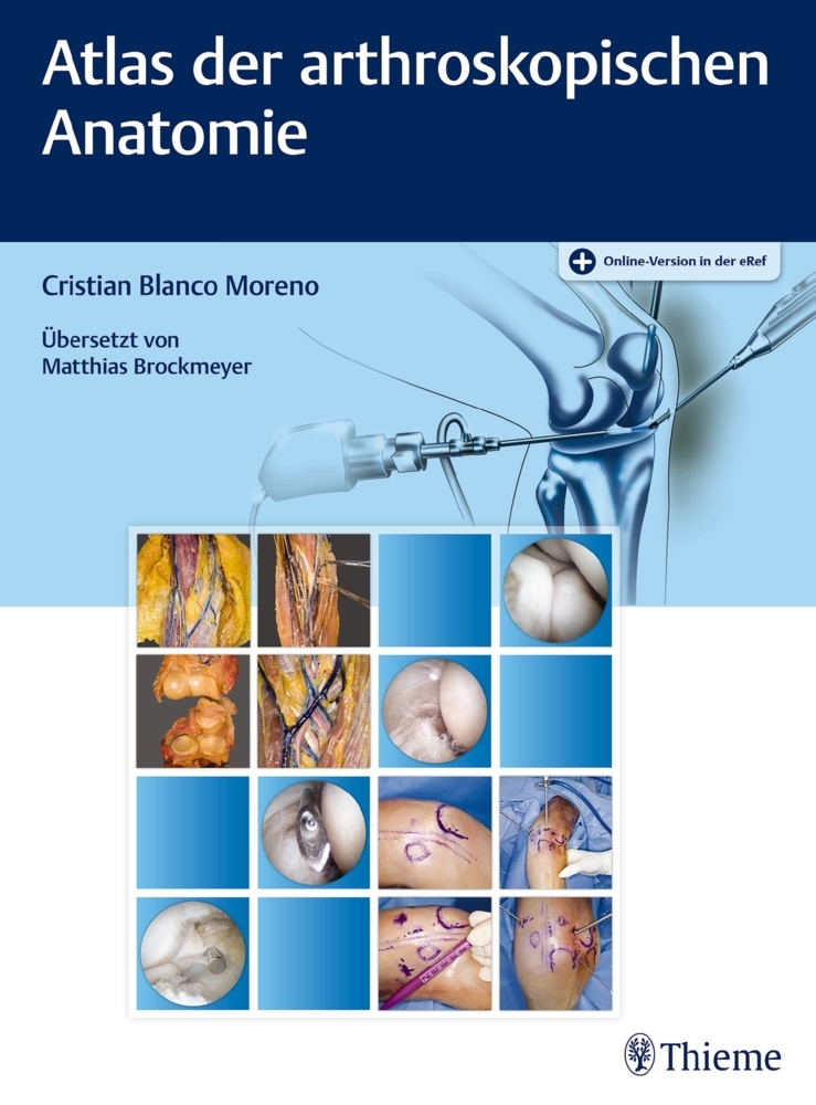 Cover: 9783132053014 | Atlas der arthroskopischen Anatomie | Cristian Blanco Moreno | Bundle