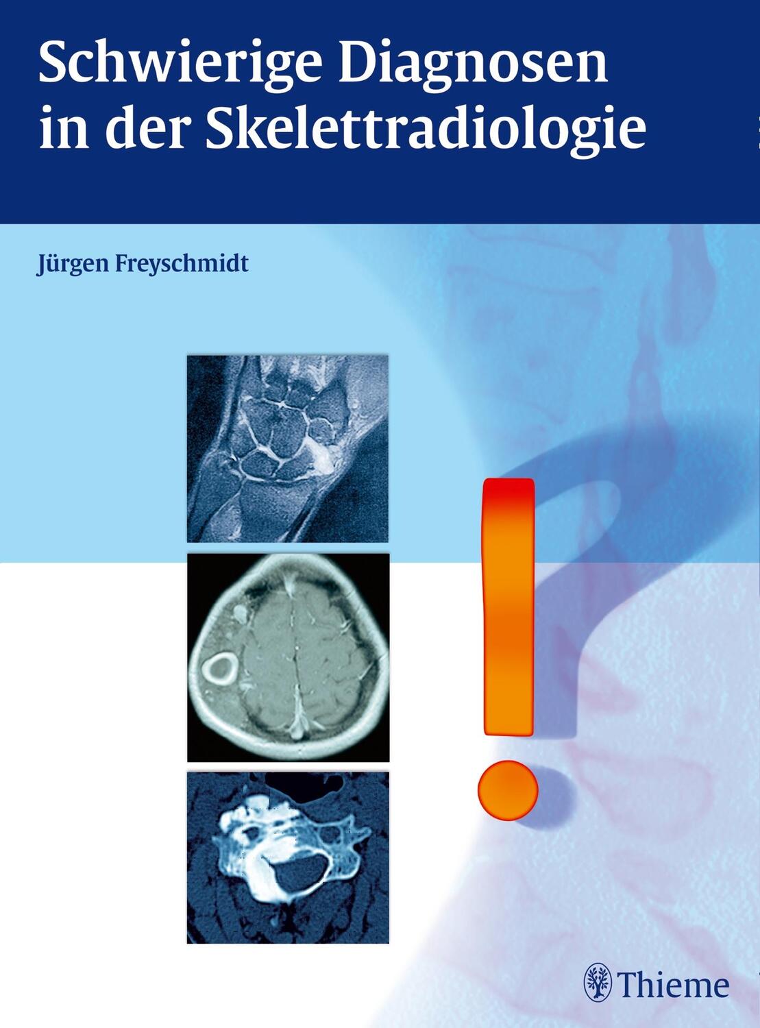 Cover: 9783132431614 | Schwierige Diagnosen in der Skelettradiologie | Jürgen Freyschmidt