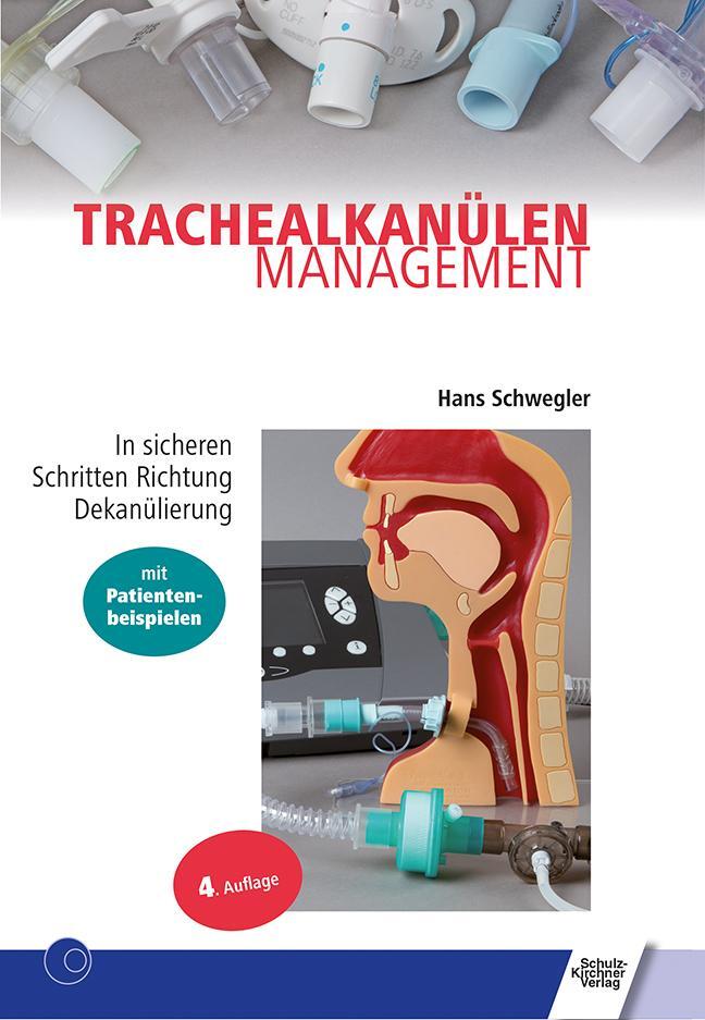 Cover: 9783824812608 | Trachealkanülenmanagement | Hans Schwegler | Taschenbuch | Deutsch