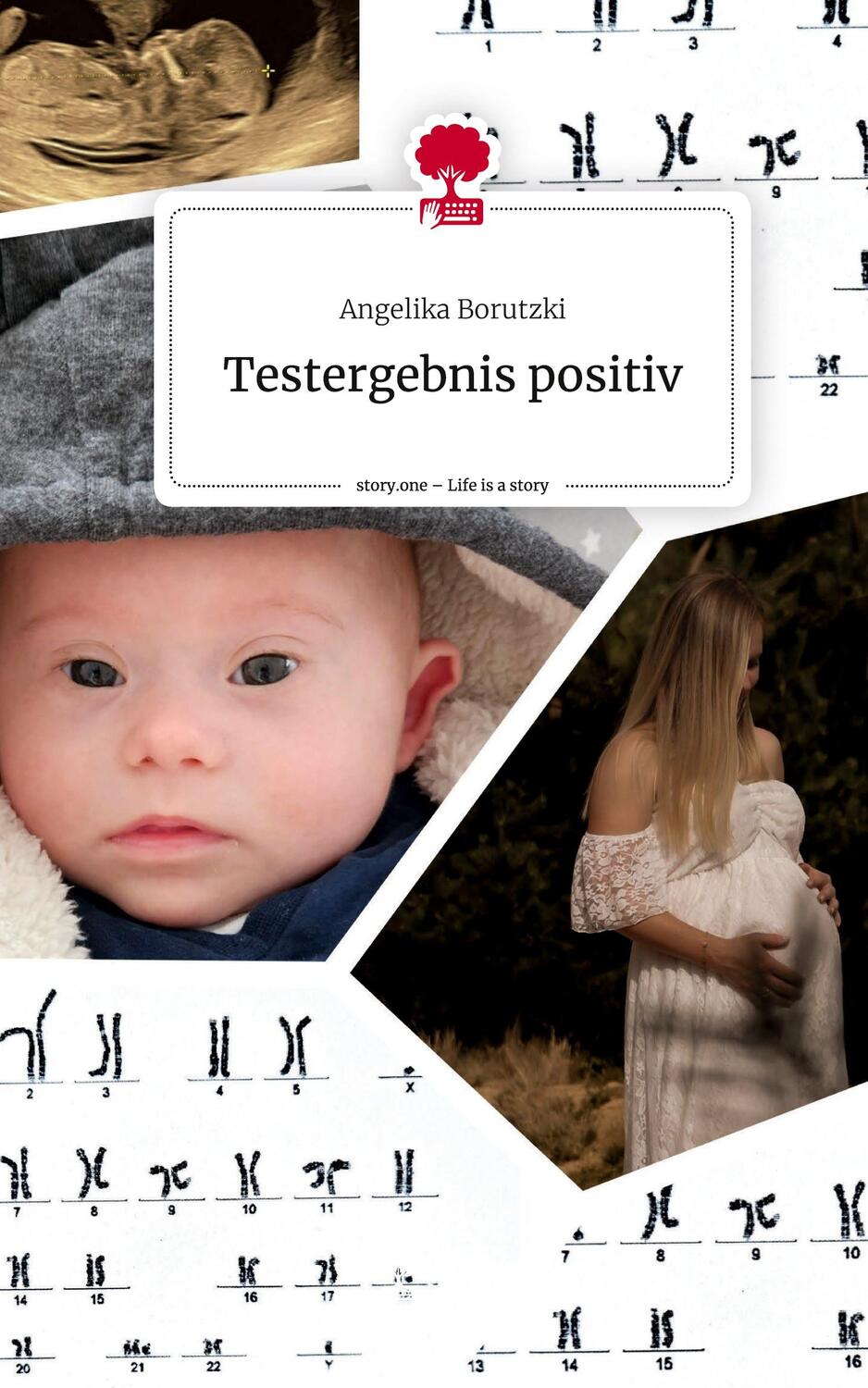 Cover: 9783711511553 | Testergebnis positiv. Life is a Story - story.one | Angelika Borutzki