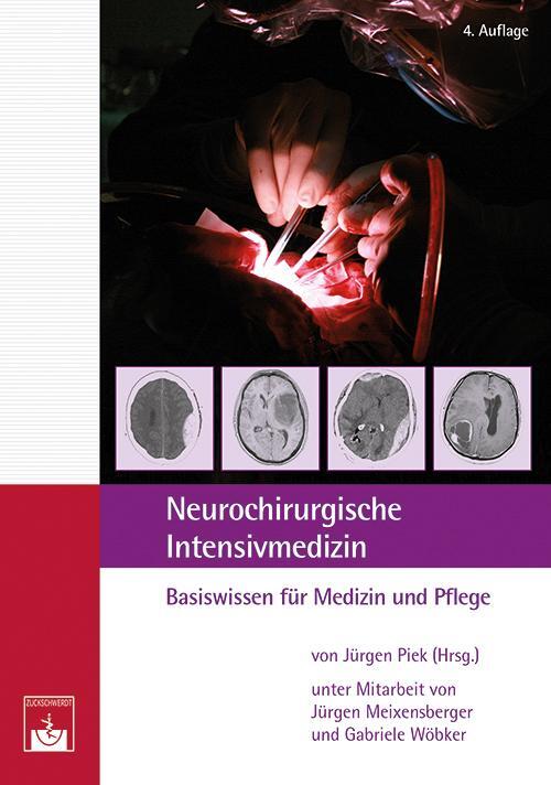 Cover: 9783863712297 | Neurochirurgische Intensivmedizin | Basiswissen für Medizin und Pflege