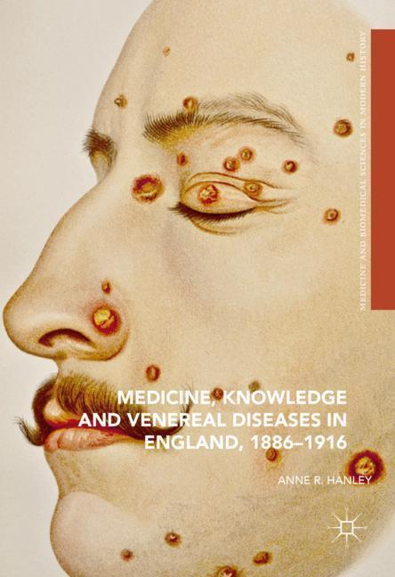 Cover: 9783319324548 | Medicine, Knowledge and Venereal Diseases in England, 1886-1916 | Buch