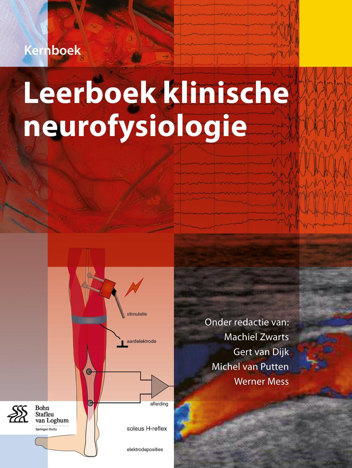 Cover: 9789036803632 | Leerboek Klinische Neurofysiologie | Machiel Zwarts (u. a.) | Buch
