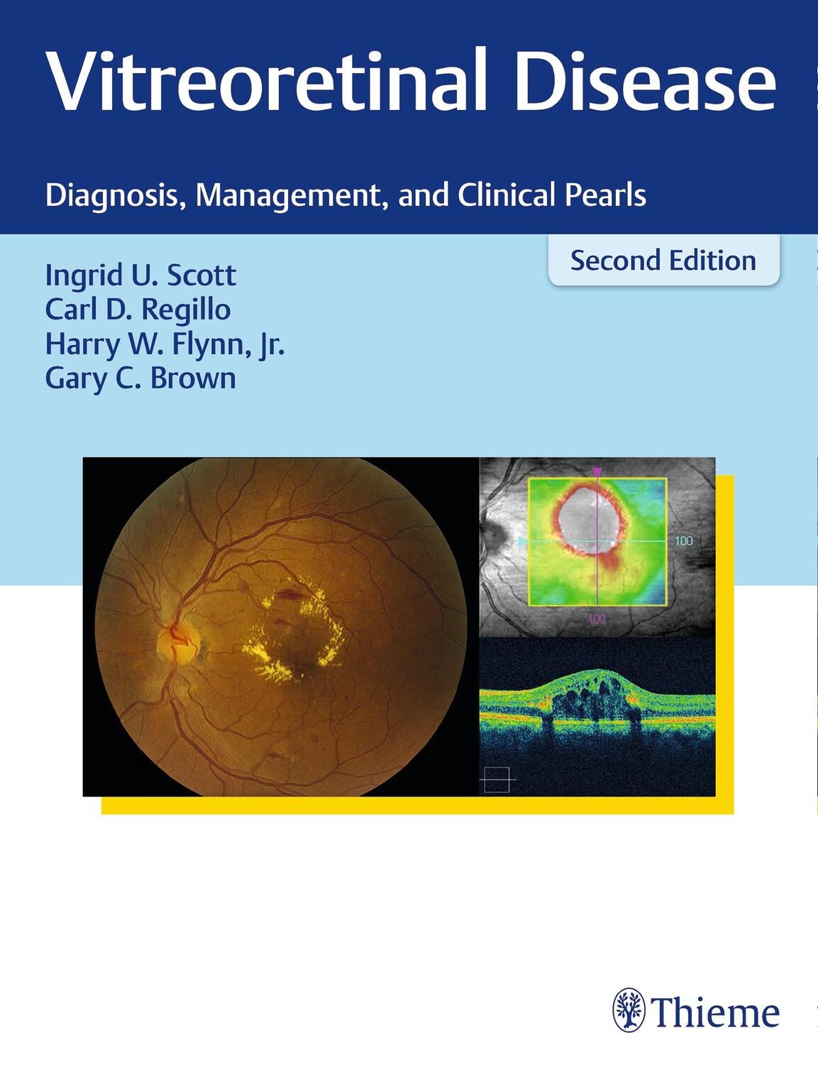 Cover: 9781626231337 | Vitreoretinal Disease: Diagnosis, Management, and Clinical Pearls