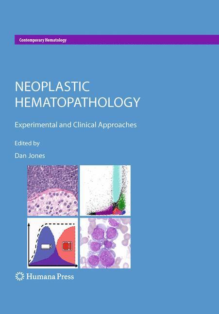 Cover: 9781607613831 | Neoplastic Hematopathology | Experimental and Clinical Approaches | xv