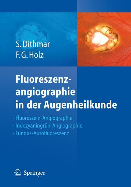 Cover: 9783540352235 | Fluoreszenzangiographie in der Augenheilkunde | Frank G. Holz (u. a.)