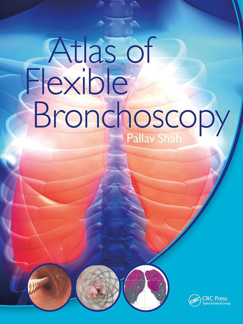 Cover: 9781032477589 | Atlas of Flexible Bronchoscopy | Pallav Shah | Taschenbuch | Englisch
