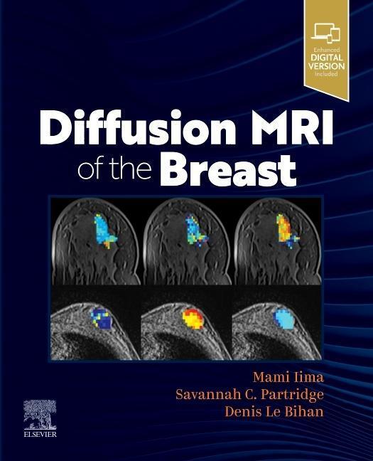 Cover: 9780323797023 | Diffusion MRI of the Breast | Denis Le Bihan (u. a.) | Taschenbuch
