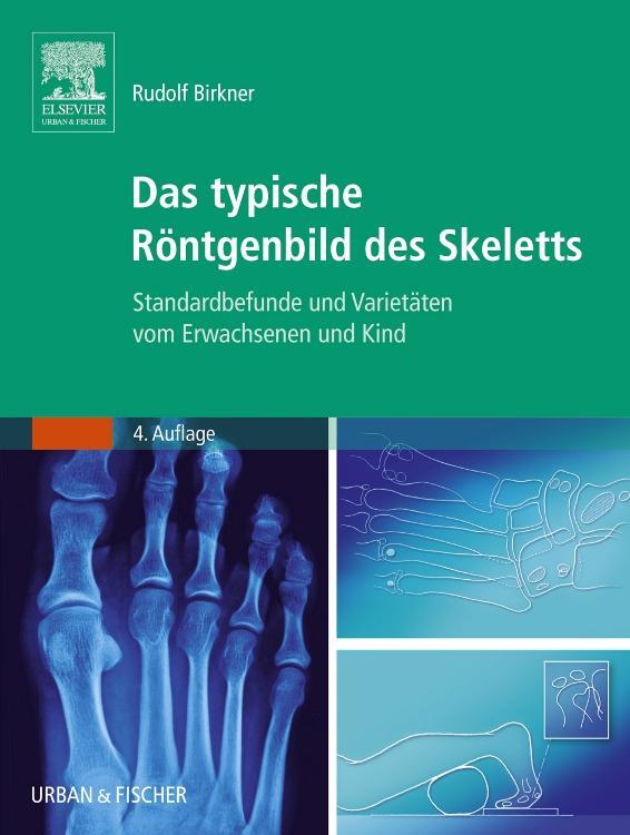 Cover: 9783437313073 | Das typische Röntgenbild des Skeletts | Rudolf Birkner | Taschenbuch