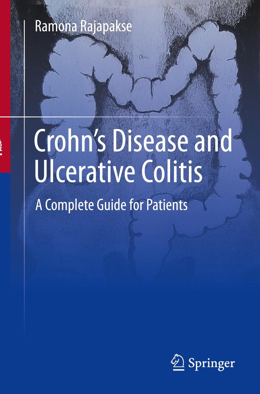 Cover: 9783031454066 | Crohn's Disease and Ulcerative Colitis | A Complete Guide for Patients