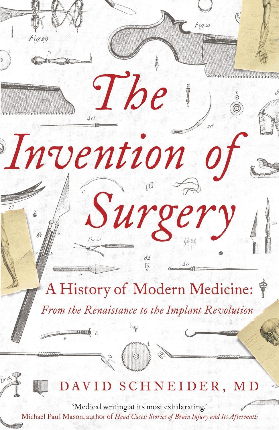 Cover: 9781529362268 | The Invention of Surgery | Dr David Schneider | Taschenbuch | Englisch