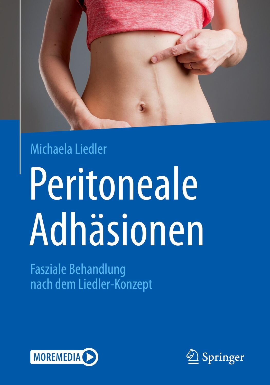 Cover: 9783662604991 | Peritoneale Adhäsionen | Fasziale Behandlung nach dem Liedler-Konzept