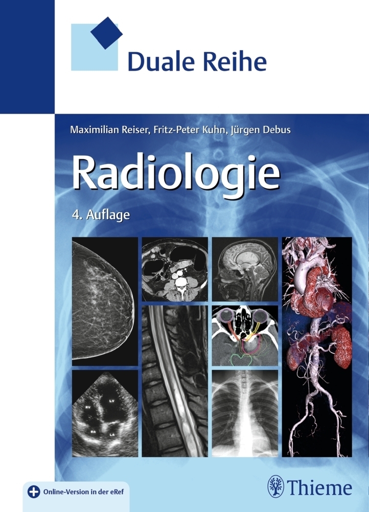 Cover: 9783131253248 | Duale Reihe Radiologie | Mit Online-Version in der eRef | Jürgen Debus
