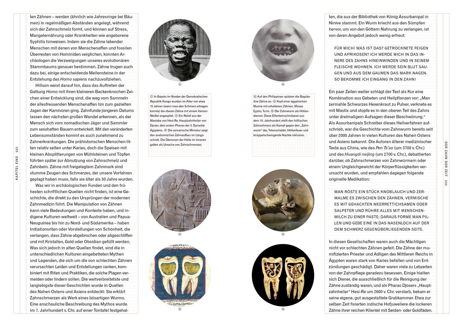 Bild: 9783832199371 | Mut zur Lücke | Kunst und Geschichte der Zahnheilkunde | Barnett