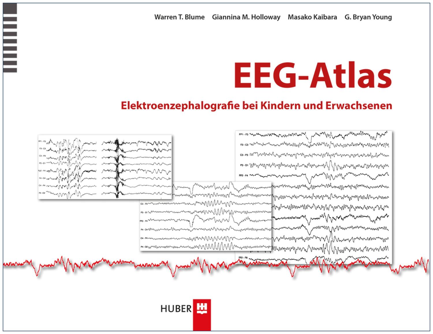 Cover: 9783456852645 | EEG-Atlas | Elektroenzephalografie bei Kindern und Erwachsenen | Buch
