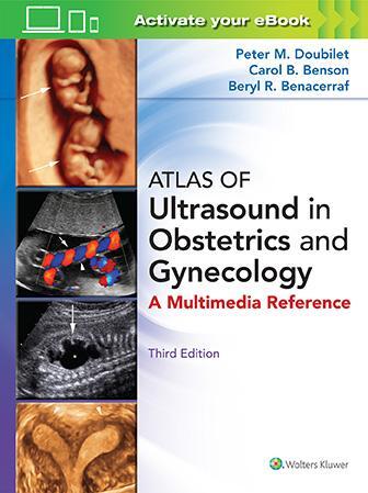 Cover: 9781496356055 | Atlas of Ultrasound in Obstetrics and Gynecology | Doubilet (u. a.)