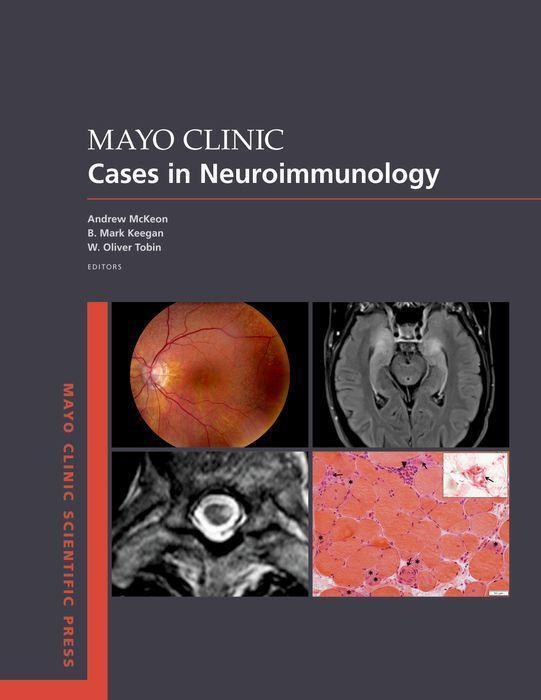 Cover: 9780197583425 | Mayo Clinic Cases in Neuroimmunology | Andrew McKeon (u. a.) | Buch