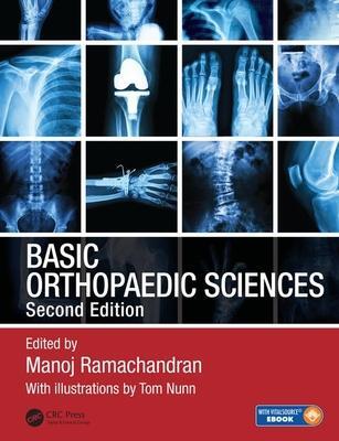 Cover: 9781444120981 | Basic Orthopaedic Sciences | Manoj Ramachandran | Taschenbuch | 2017