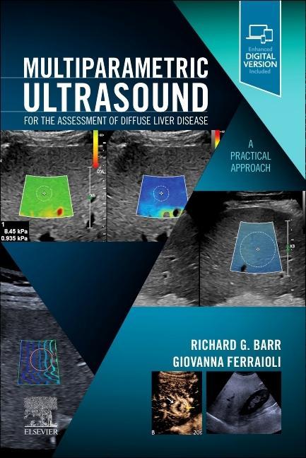 Cover: 9780323874793 | Multiparametric Ultrasound for the Assessment of Diffuse Liver Disease