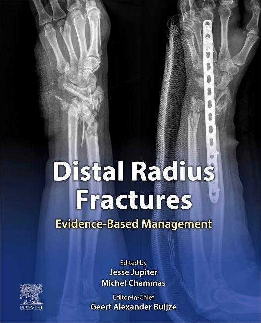 Cover: 9780323757645 | Distal Radius Fractures | Evidence-Based Management | Jupiter (u. a.)
