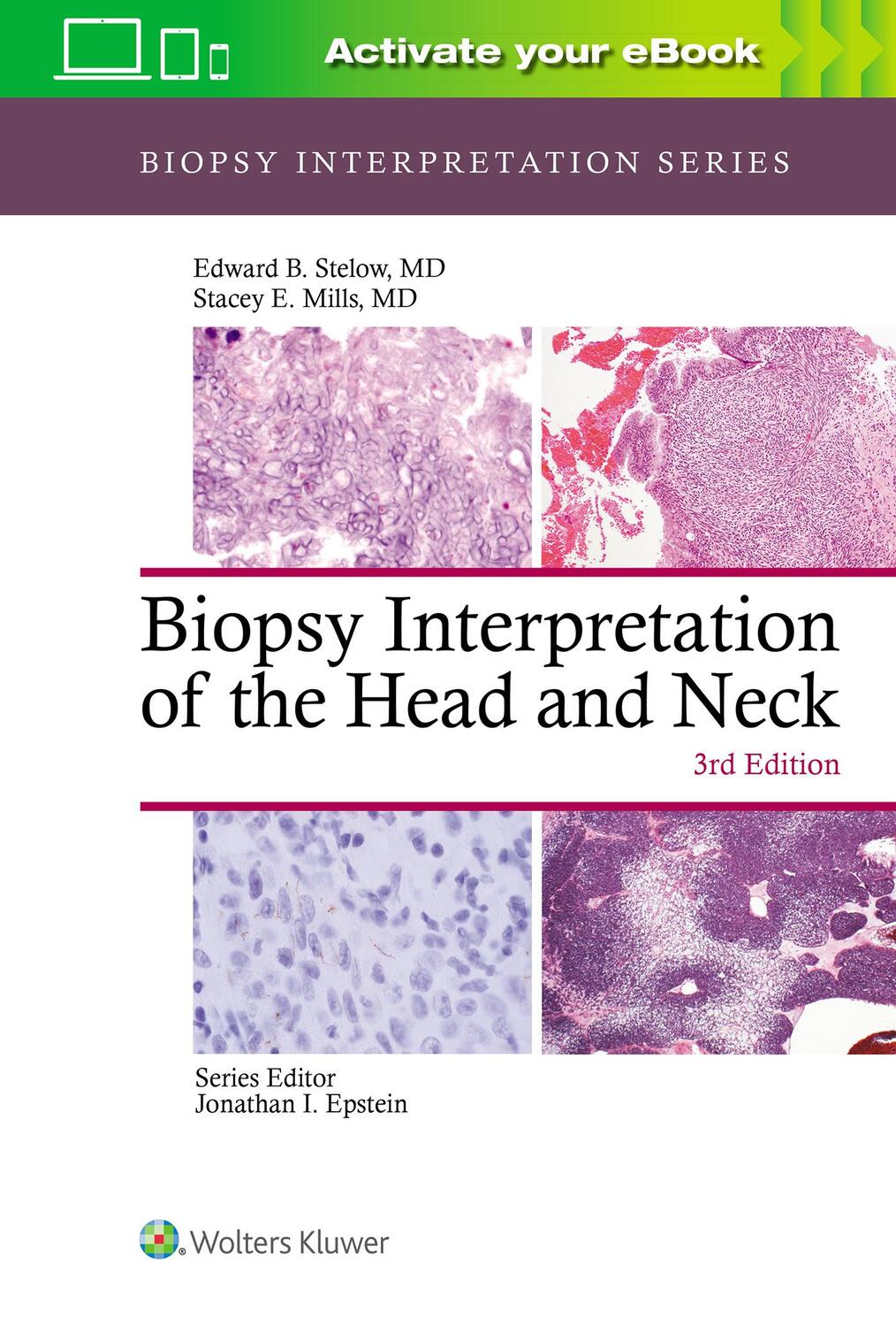 Cover: 9781975139360 | Biopsy Interpretation of the Head and Neck | Edward B. Stelow (u. a.)