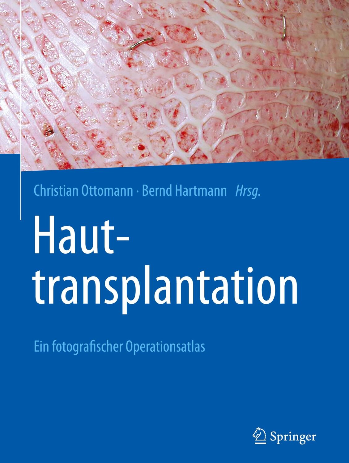 Cover: 9783662620595 | Hauttransplantation | Ein fotografischer Operationsatlas | Buch | xiv