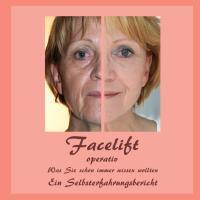 Cover: 9783732237791 | Facelift operativ | Bernhard Siegmund (u. a.) | Taschenbuch