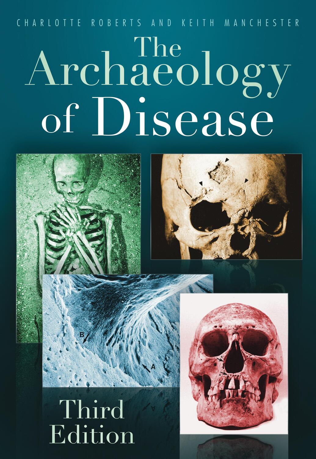 Cover: 9780752457505 | The Archaeology of Disease | Third Edition | Charlotte Roberts (u. a.)