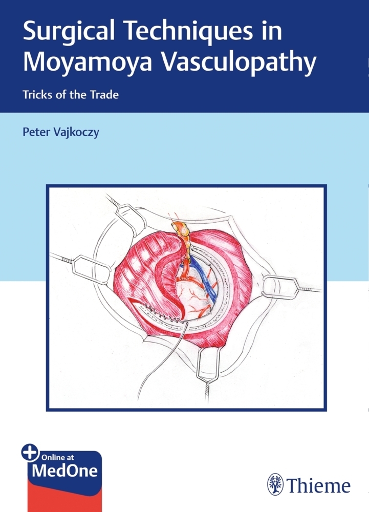 Cover: 9783131450616 | Surgical Techniques in Moyamoya Vasculopathy | Peter Vajkoczy | Bundle